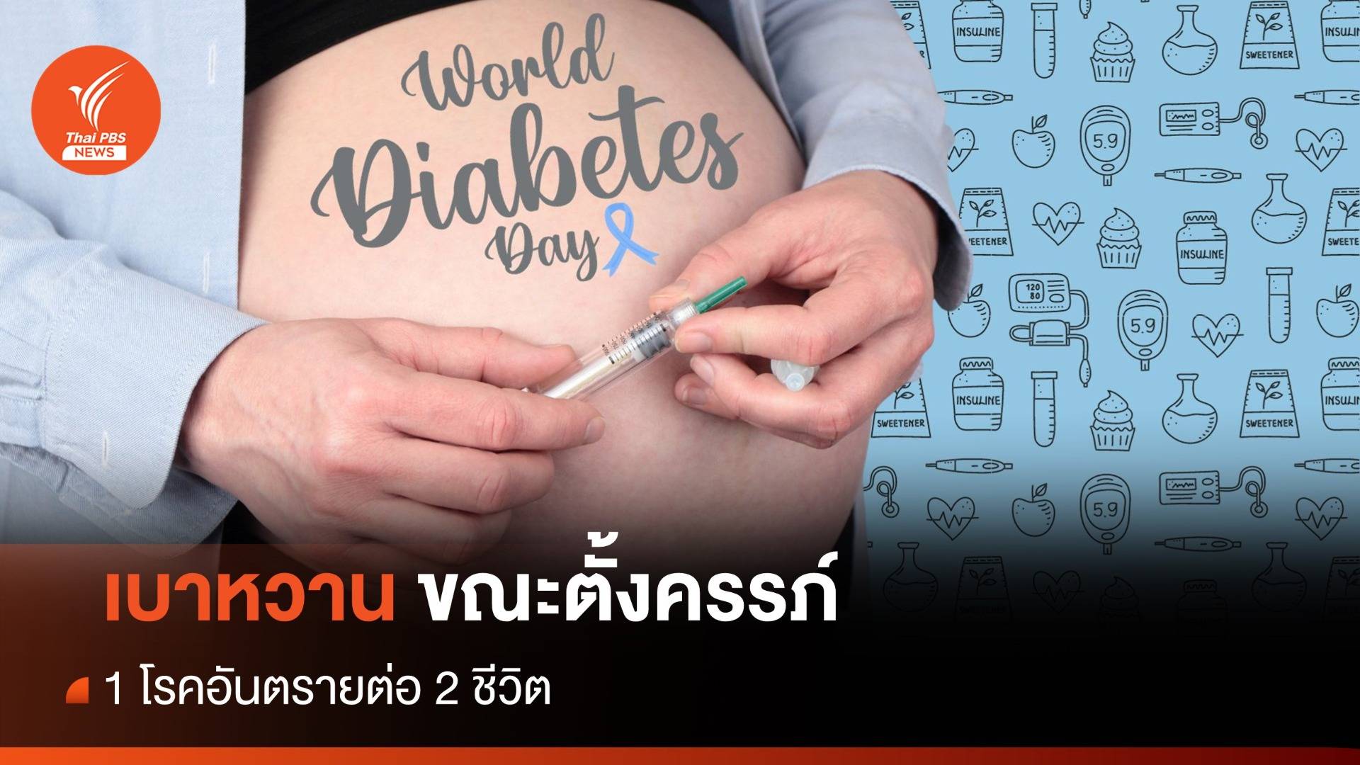 วันเบาหวานโลก รู้จัก "เบาหวานขณะตั้งครรภ์" 1 โรคอันตรายของ 2 ชีวิต