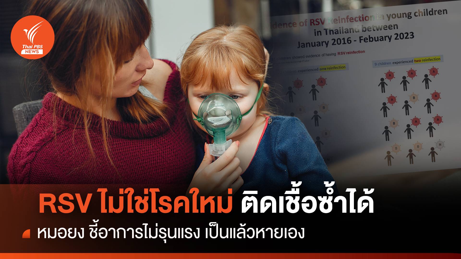 หมอยง ชี้ RSV ไม่ใช่โรคใหม่ ติดเชื้อซ้ำได้