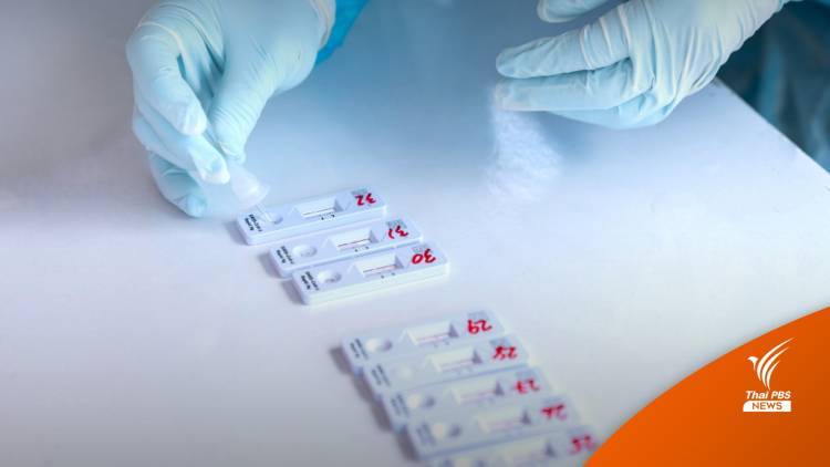 สธ.เตือนติดโควิดกักตัวไม่ครบ 10 วันพบออกใช้ชีวิตนอกบ้าน