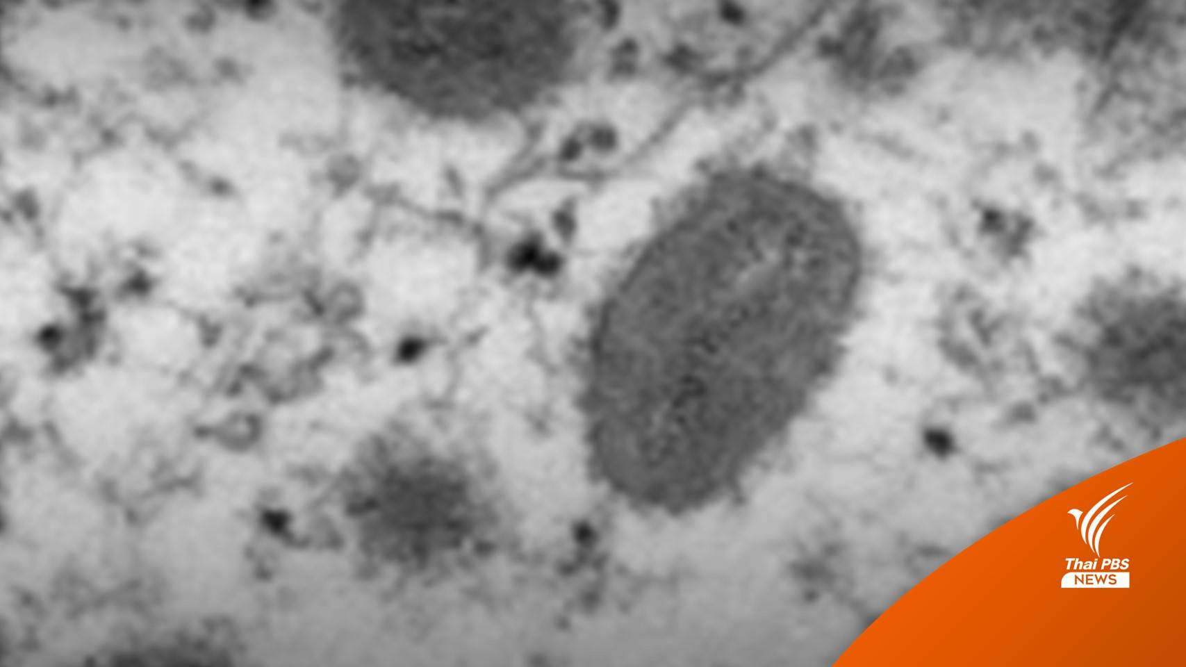 ทีมวิจัย ม.นเรศวร เก็บน้ำเสีย ตรวจหาซากเชื้อ "ฝีดาษลิง"