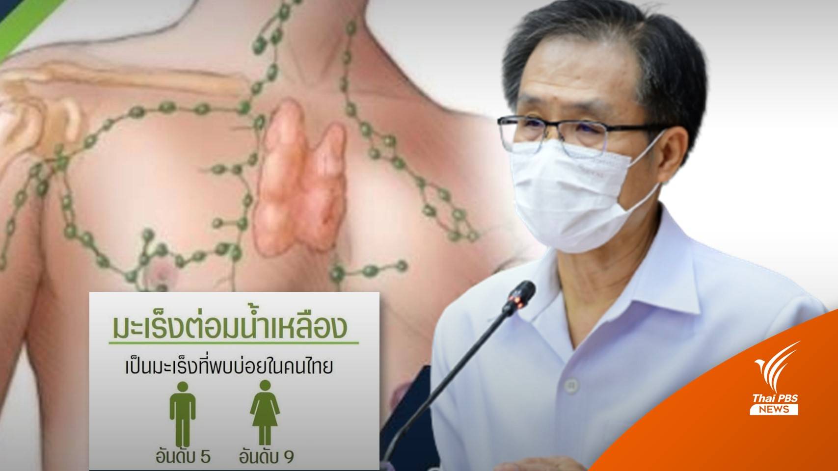 "มะเร็งต่อมน้ำเหลือง" พบบ่อยในคนไทย แนะหมั่นสังเกตตนเอง