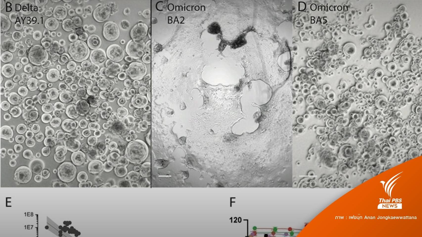 งานวิจัยออสเตรเลียพบ " BA.5" ปรับตัวเข้าสู่เซลล์ปอดได้ง่ายขึ้น  