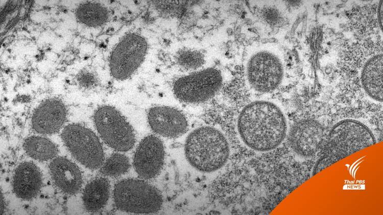 ไทม์ไลน์ "ฝีดาษลิง" คนที่ 3 กลุ่มเสี่ยงแฟนคนไทย-ครอบครัว 7 คน