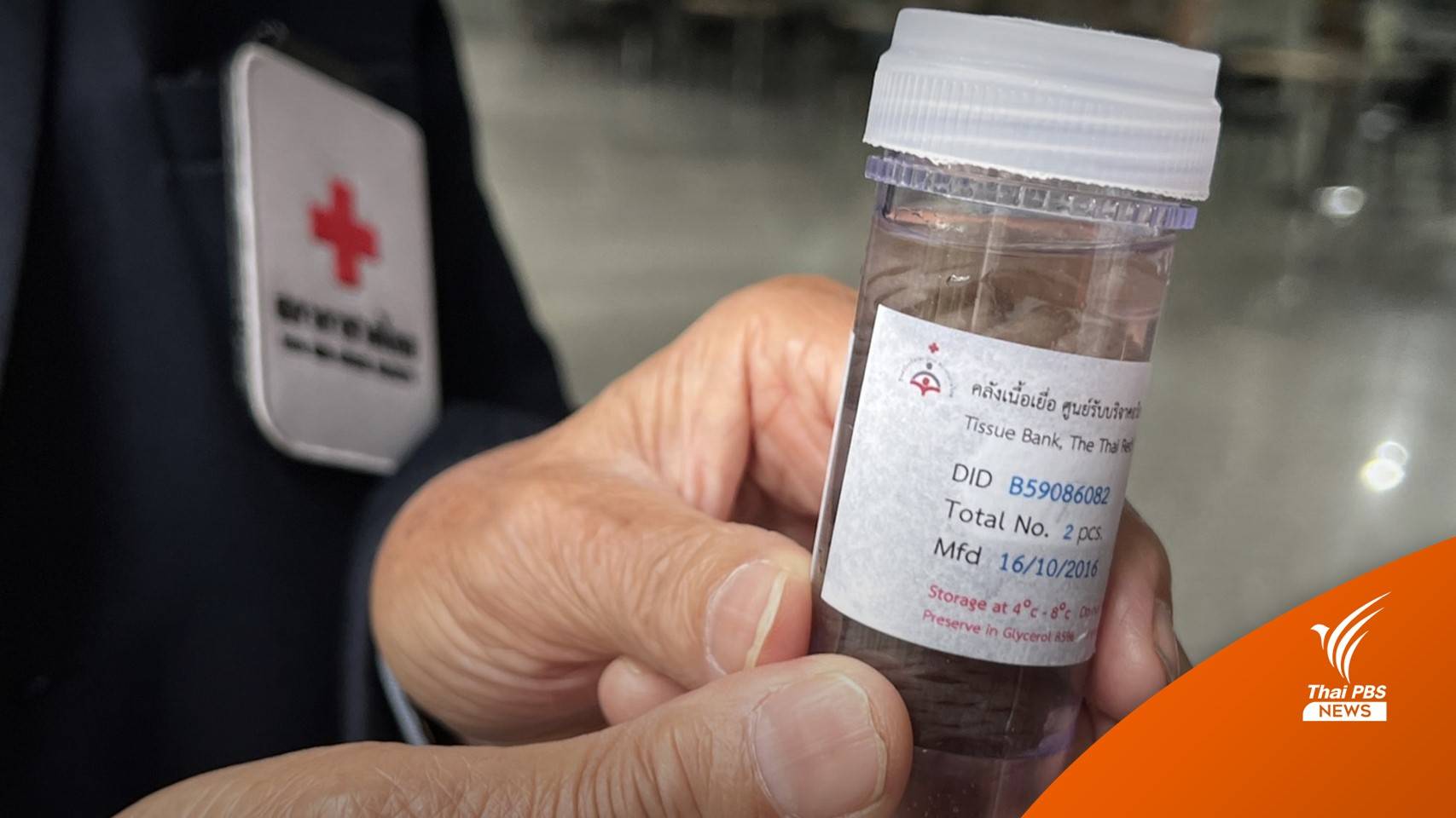 "ผิวหนังแท้" อะไหล่จริง ฟื้นผู้ป่วยไฟไหม้ MOUNTAIN B