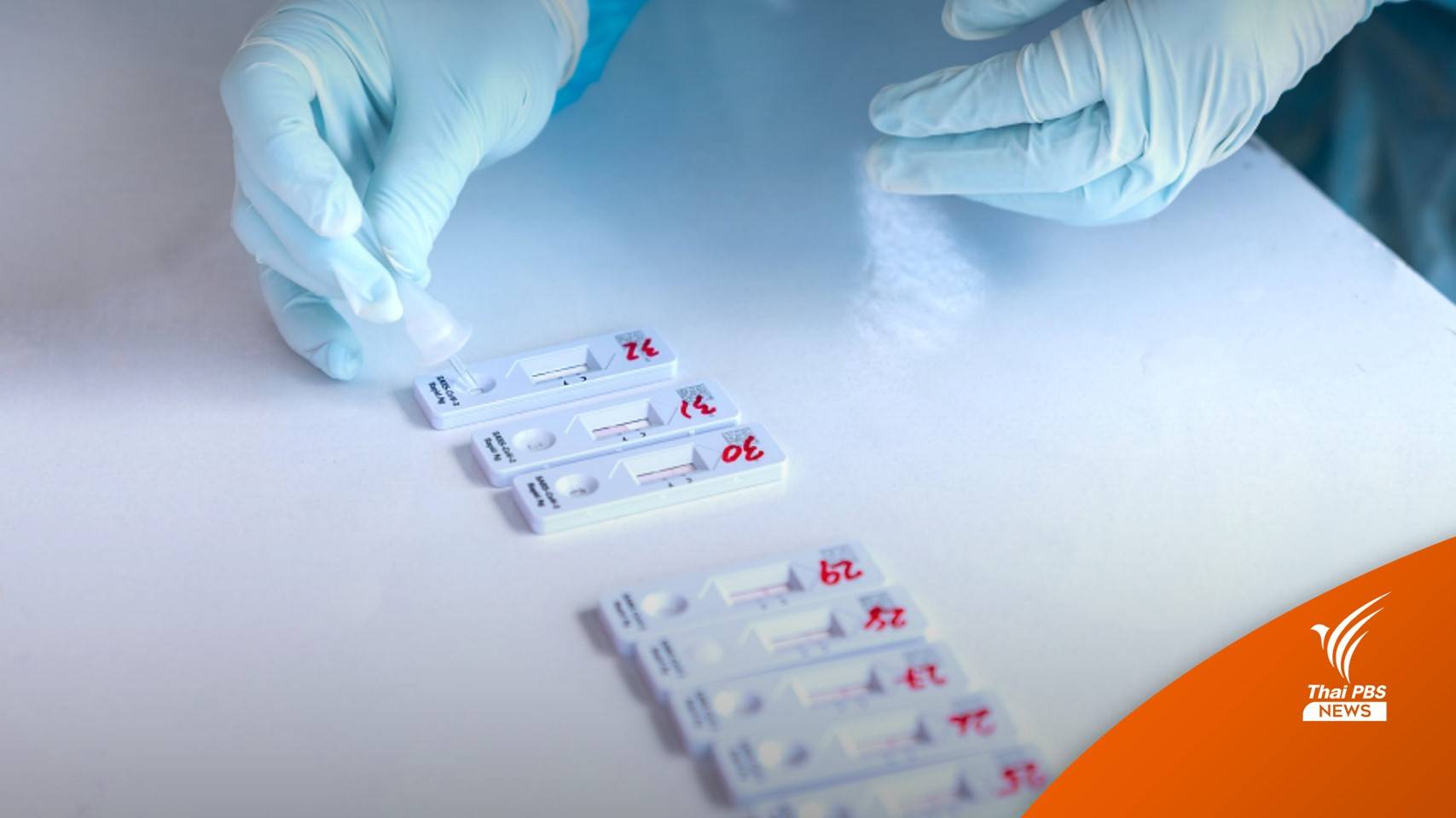 ปรับสถานะ "โควิด" จากโรคติดต่ออันตราย เป็นต้องเฝ้าระวัง 1 ต.ค.