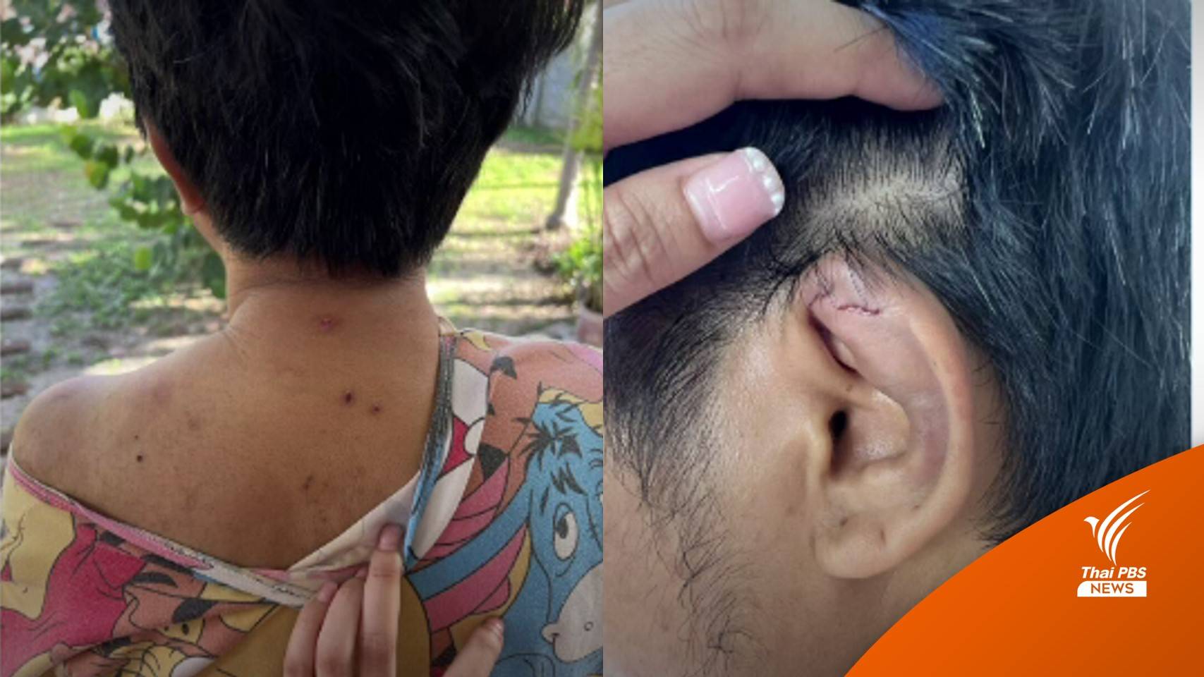 "ทหารหญิง" แจ้งความอ้างนายจ้างภรรยา ส.ว.ทำร้ายร่างกาย