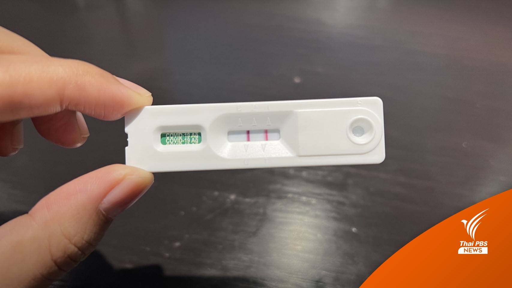 เช็กเงื่อนไขโควิด "กลุ่มสีแดง" เข้าเกณฑ์ UCEP เริ่ม 1 ต.ค.นี้