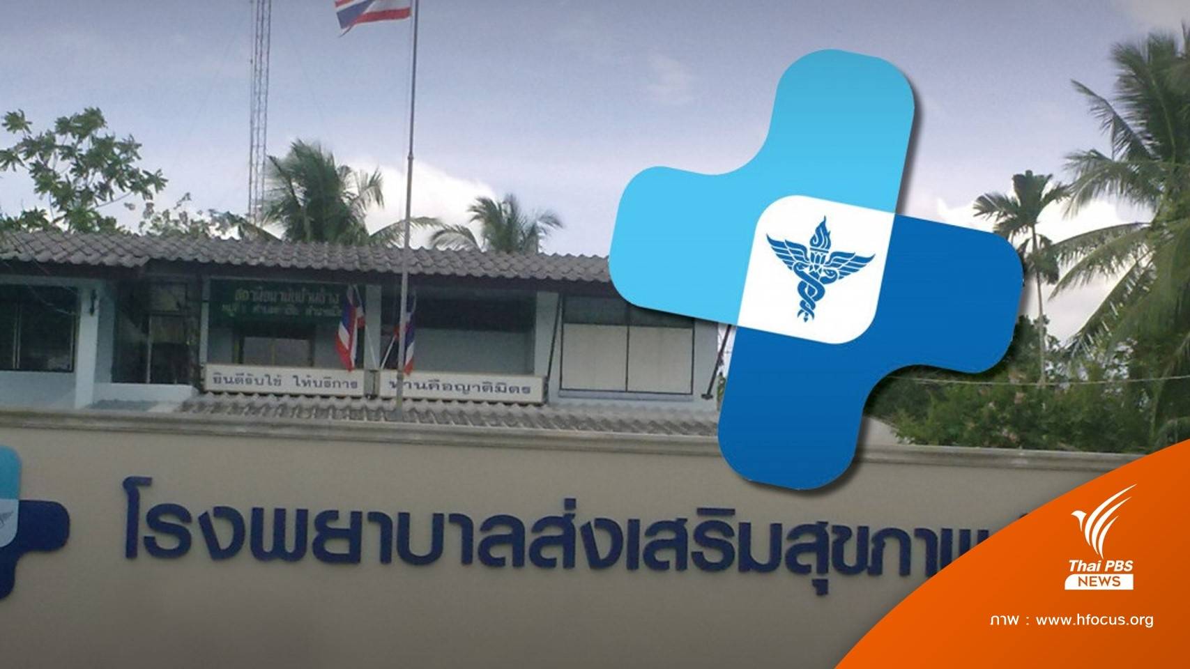 9,000 อัตรา รพ.สต.เคว้งช่วงเปลี่ยนย้ายสังกัด อบจ.