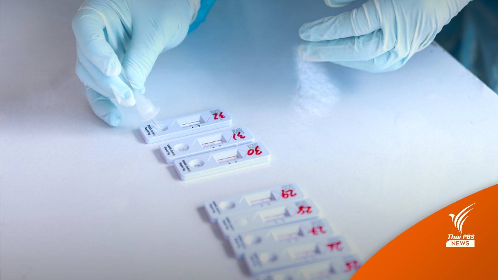 เห็นชอบปลด "โควิด" ออกจากโรคต้องห้ามสำหรับต่างด้าวเข้าประเทศ