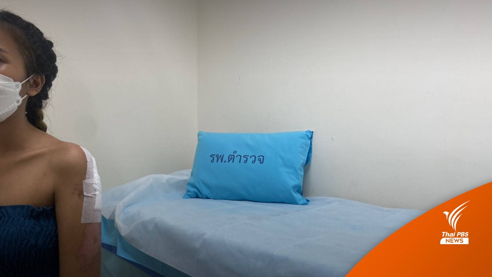 รพ.ตำรวจ ช่วยเย็บแผลฟรี "หญิงลาว" บาดเจ็บไฟไหม้ Mountain B