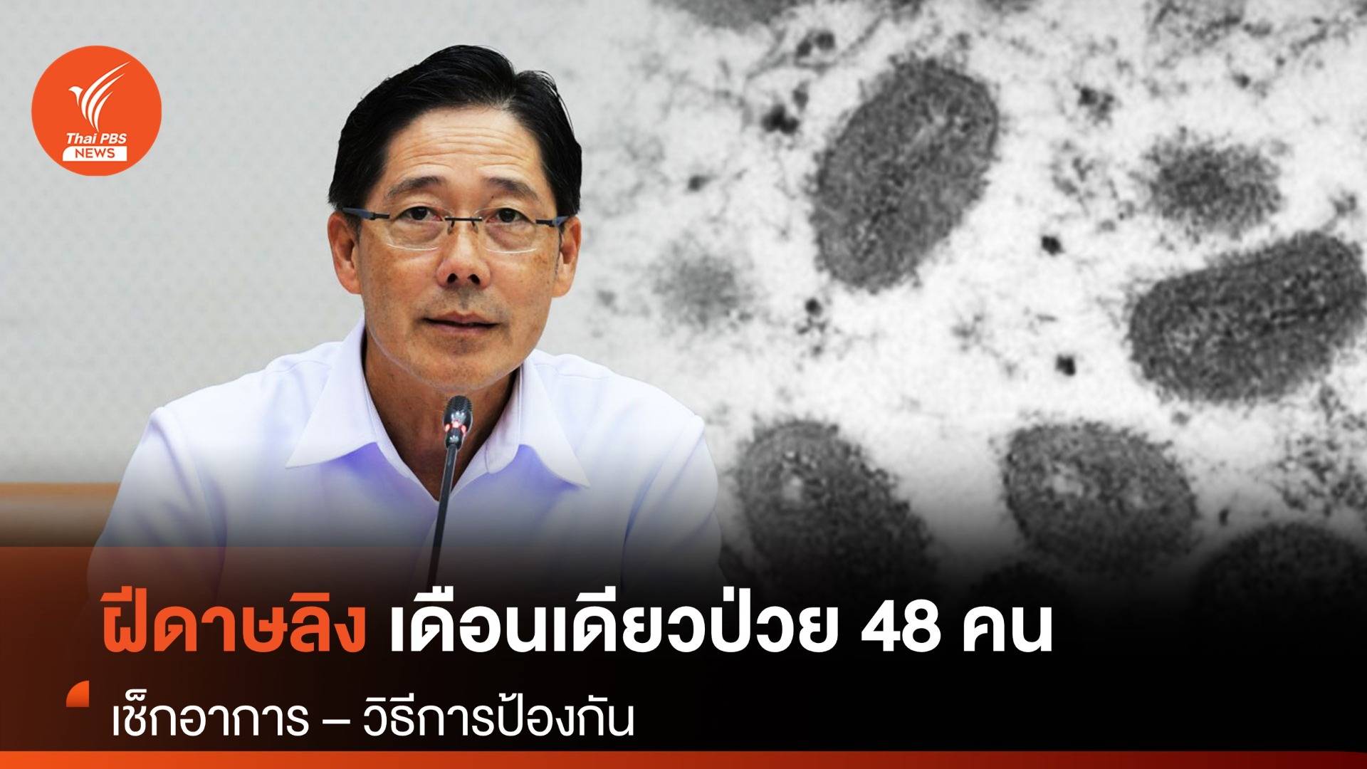 เดือนเดียวป่วย "ฝีดาษลิง" เพิ่ม 48 คน สูงขึ้น 2.3 เท่า