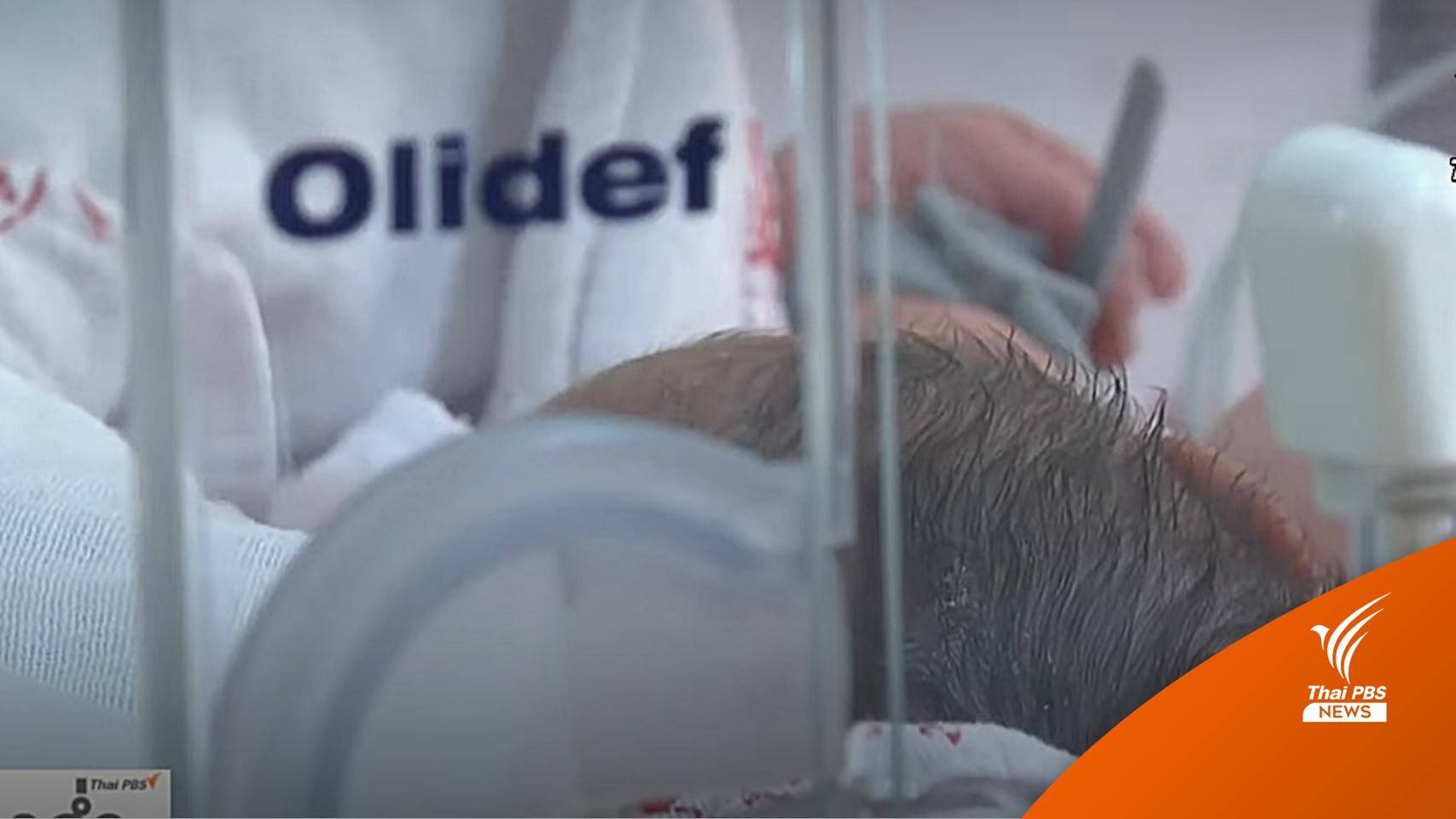 "รพ.แม่จัน" ค่าฝุ่นพิษสูงห้องเด็กแรกเกิด-หมอขอเครื่องฟอกอากาศ