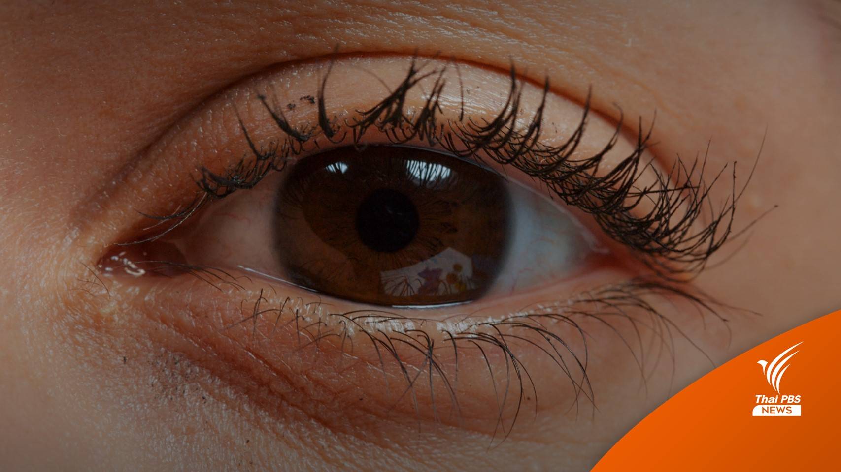 อย.ยัน "น้ำตาเทียม" 2 ยี่ห้อที่พบเชื้อแบคทีเรีย ไม่มีนำเข้าในไทย