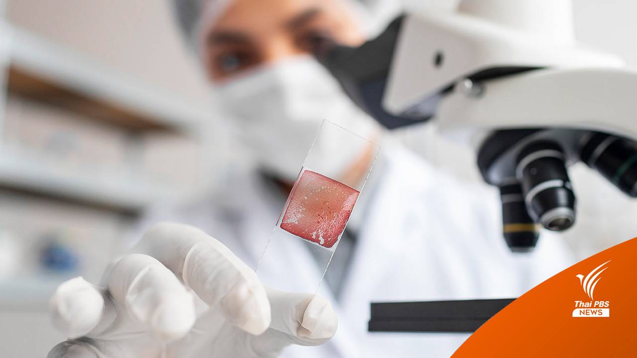 อิสราเอลสร้างหุ่นยนต์ไฮบริดขนาดจิ๋ว ช่วยตรวจจับเซลล์ที่ผิดปกติในร่างกาย