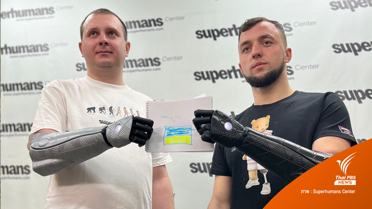 "Hero Arms" แขนเทียมสุดล้ำ มอบให้ทหารยูเครนบาดเจ็บจากสงคราม