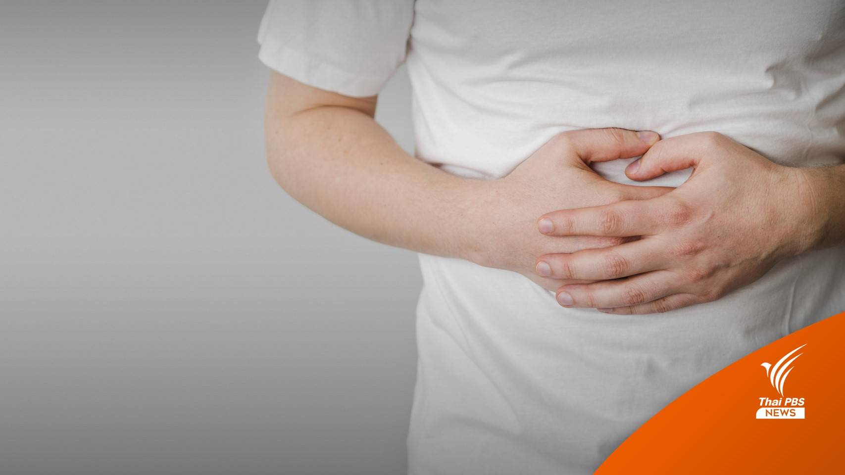 กรมการแพทย์ เปิดตัวเลขป่วย "มะเร็งลำไส้ใหญ่-ไส้ตรง" ปีละ 1.5 หมื่นคน