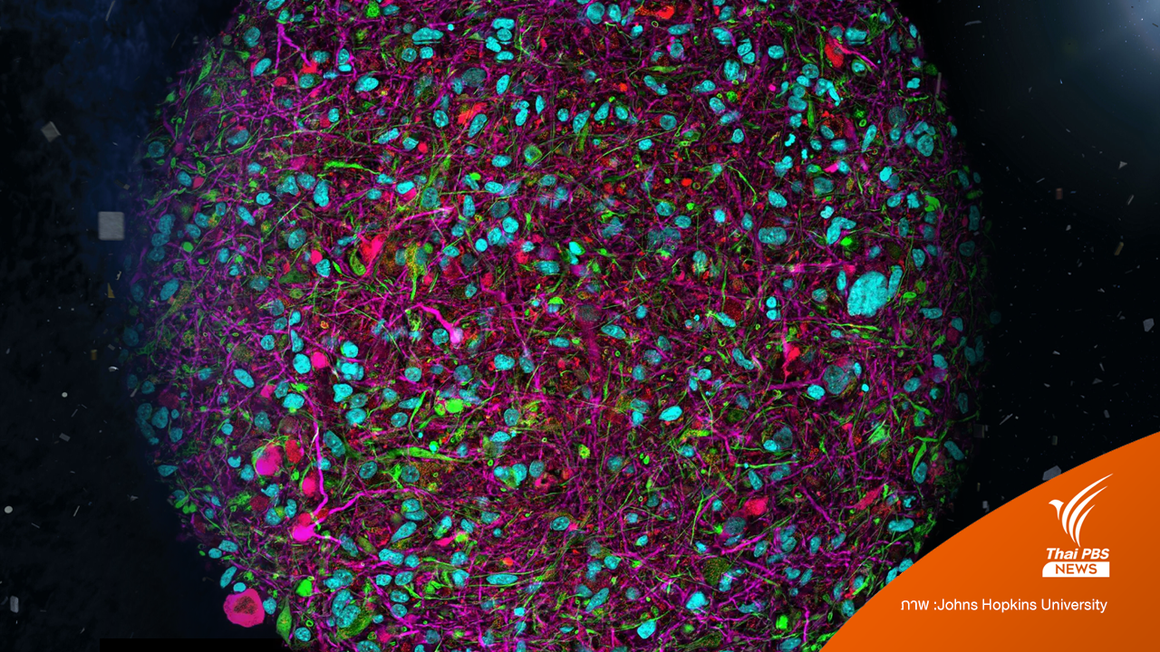 คอมพิวเตอร์ชีวภาพจากเซลล์สมองมนุษย์ คู่แข่งของ AI ในอนาคต ?