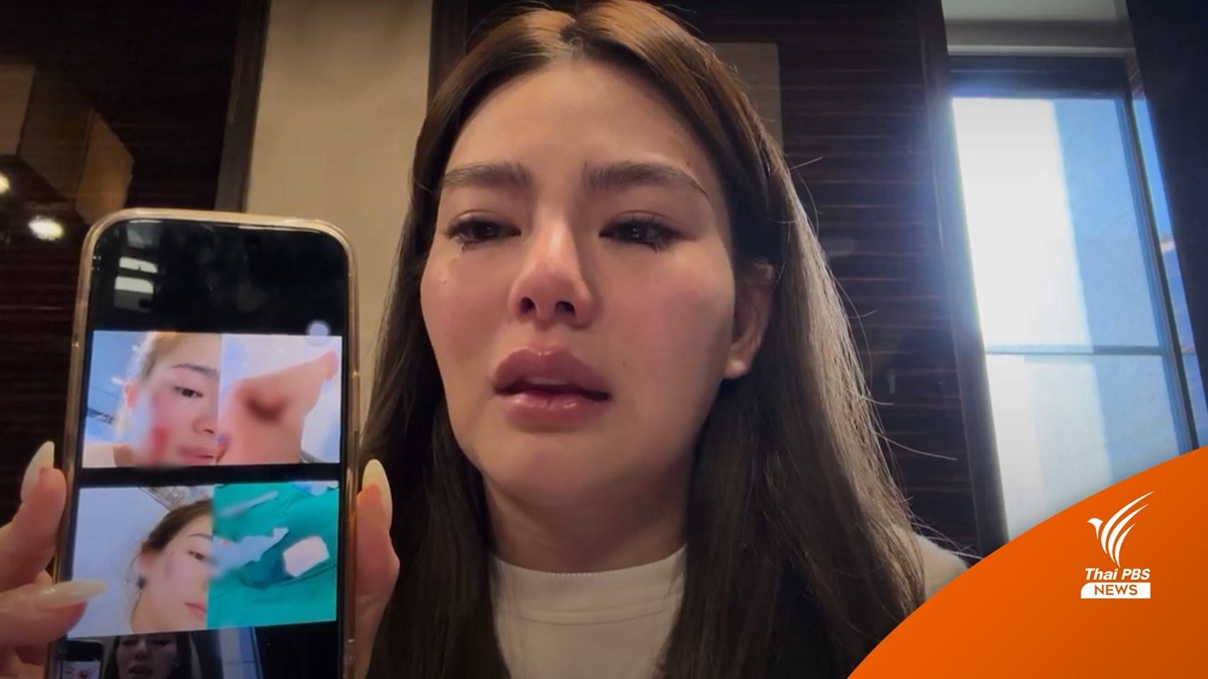 "ดิว อริสรา" เปิดใจครั้งแรกถูกอดีตแฟนทำร้ายร่างกาย ปมแฉ "บ." มาเก๊า 888