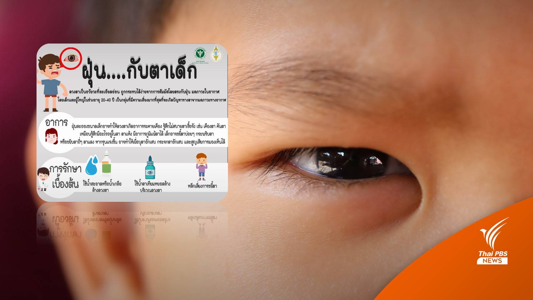 ฝุ่น PM 2.5 อันตรายต่อดวงตาของเด็ก แพทย์แนะข้อควรปฎิบัติ 
