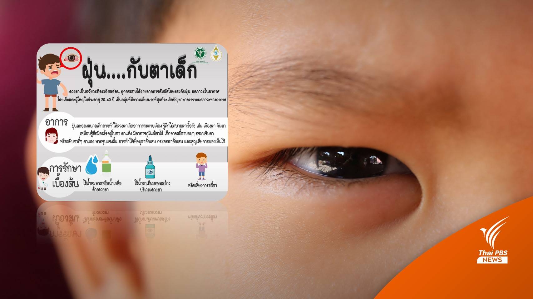ฝุ่น PM 2.5 อันตรายต่อดวงตาของเด็ก แพทย์แนะข้อควรปฎิบัติ