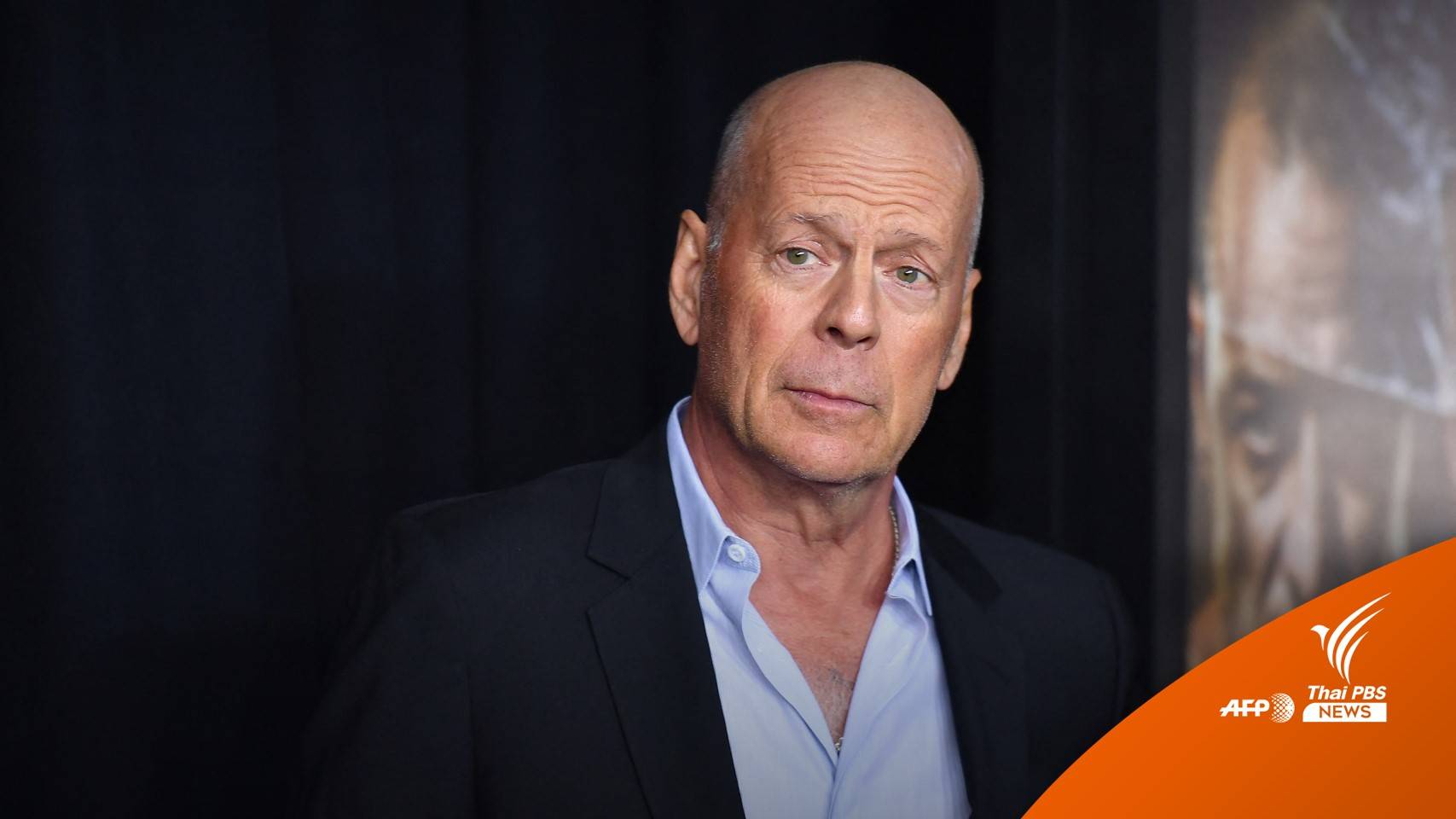 ครอบครัวแถลง "บรูซ วิลลิส" ป่วยโรคสมองส่วนหน้าเสื่อม