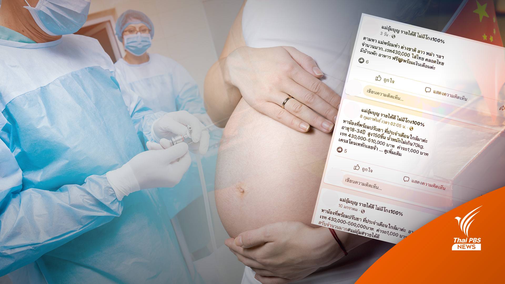 แก๊งอุ้มบุญ Come Back เปิดเพจรับสมัครสาวอุ้มบุญ