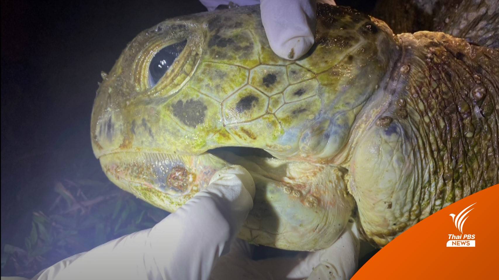 "เต่าตนุ" คลื่นซัดเกยหาดเกาะพะงัน พบบาดแผลถูกเชือกรัดจนกรามหัก