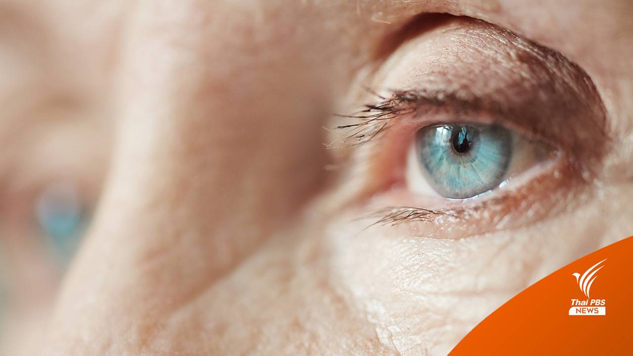 การพิมพ์ 3 มิติ ช่วยสร้างเนื้อเยื่อตา ความหวังรักษา "โรคจอประสาทตาเสื่อม"