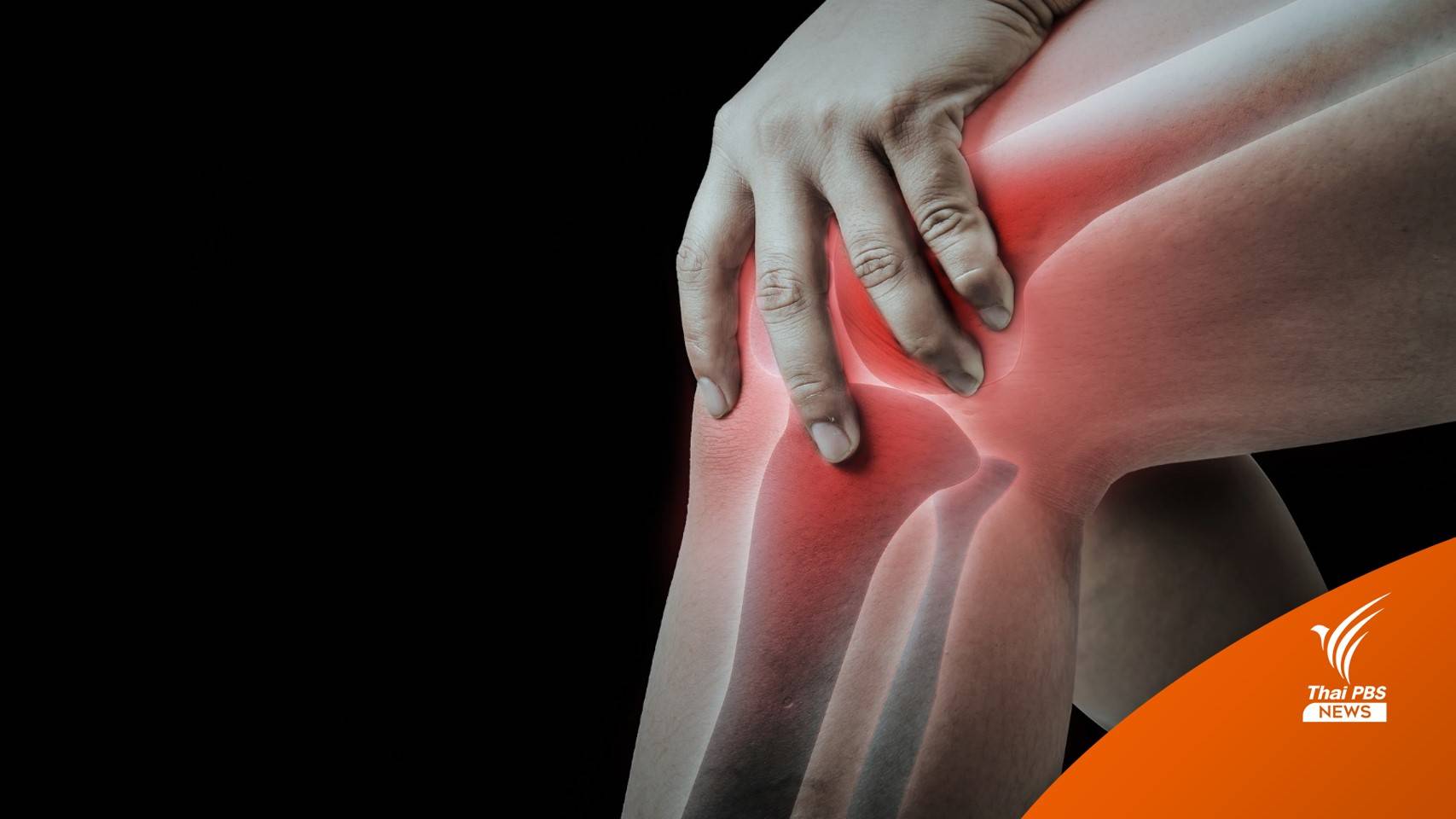 สปสช. ประกาศหลักเกณฑ์ค่าใช้จ่ายผ่าตัดข้อเข่าเทียม-ดูแลแบบผู้ป่วยในที่บ้าน