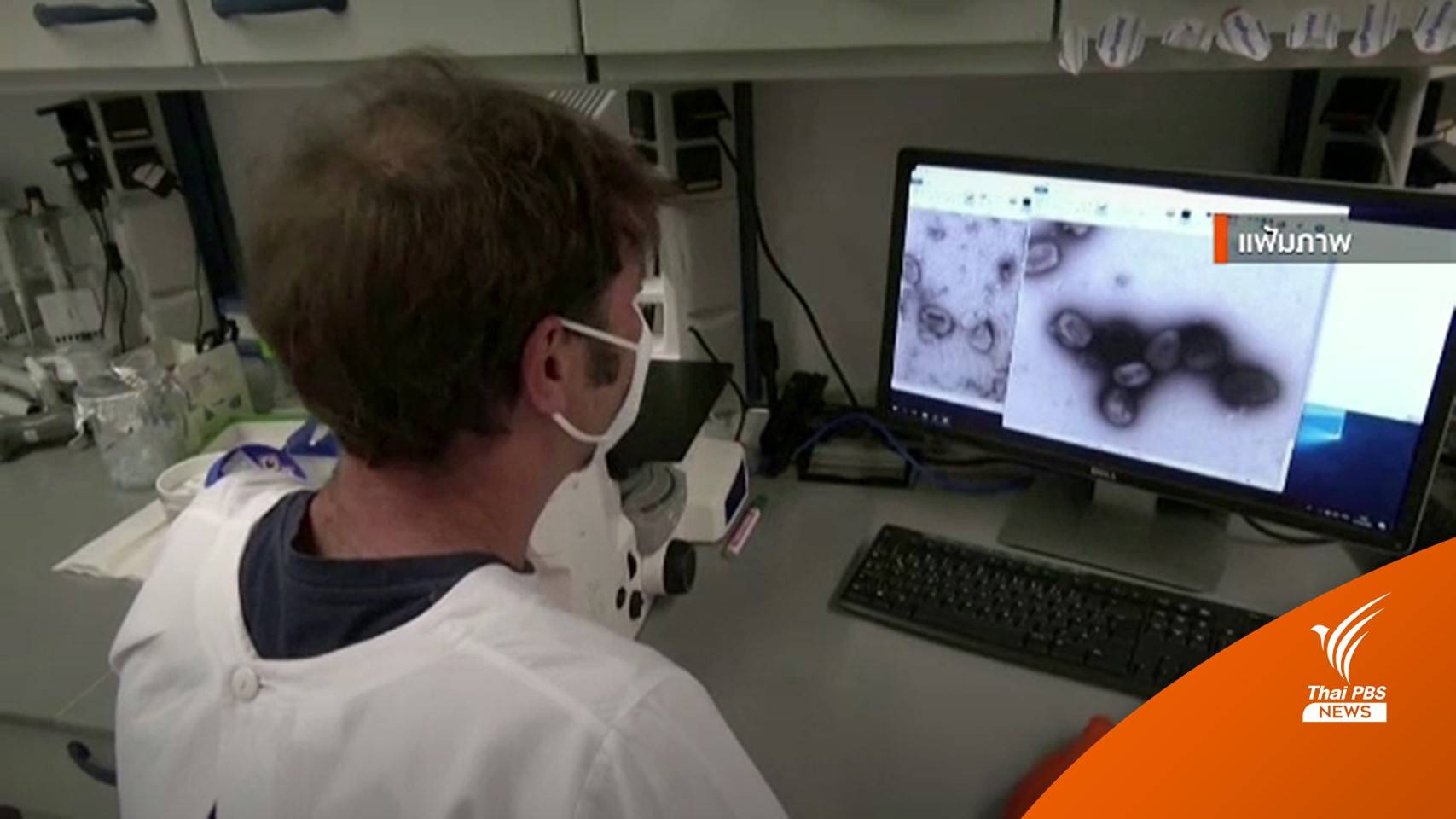 CDC ยังไม่พบรายงานการแพร่เชื้อทางอากาศของ "ฝีดาษลิง"