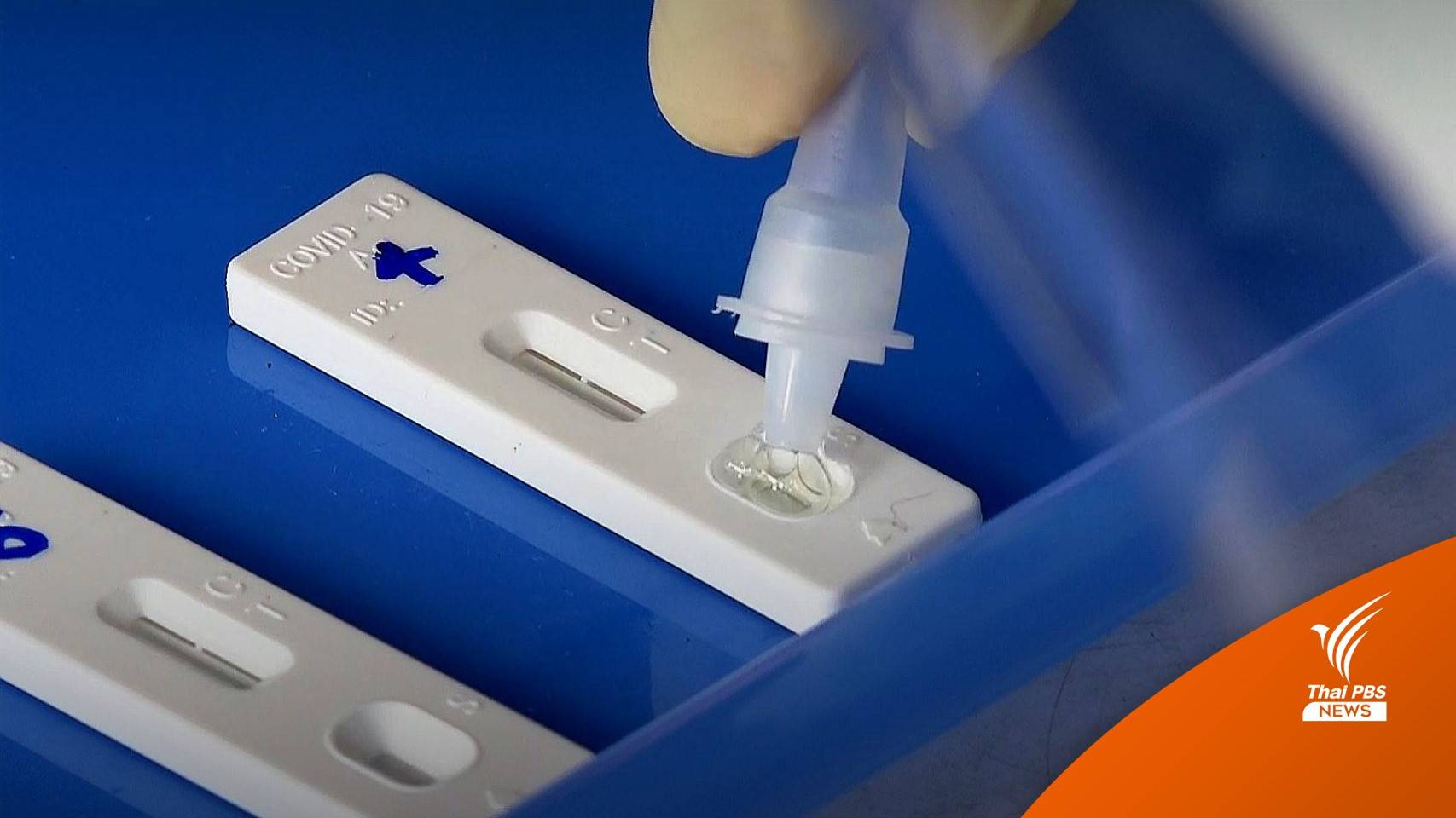 1 ก.ค.นี้ สปสช.ยกเลิกจ่ายค่าตรวจโควิด รพ.นอกระบบบัตรทอง