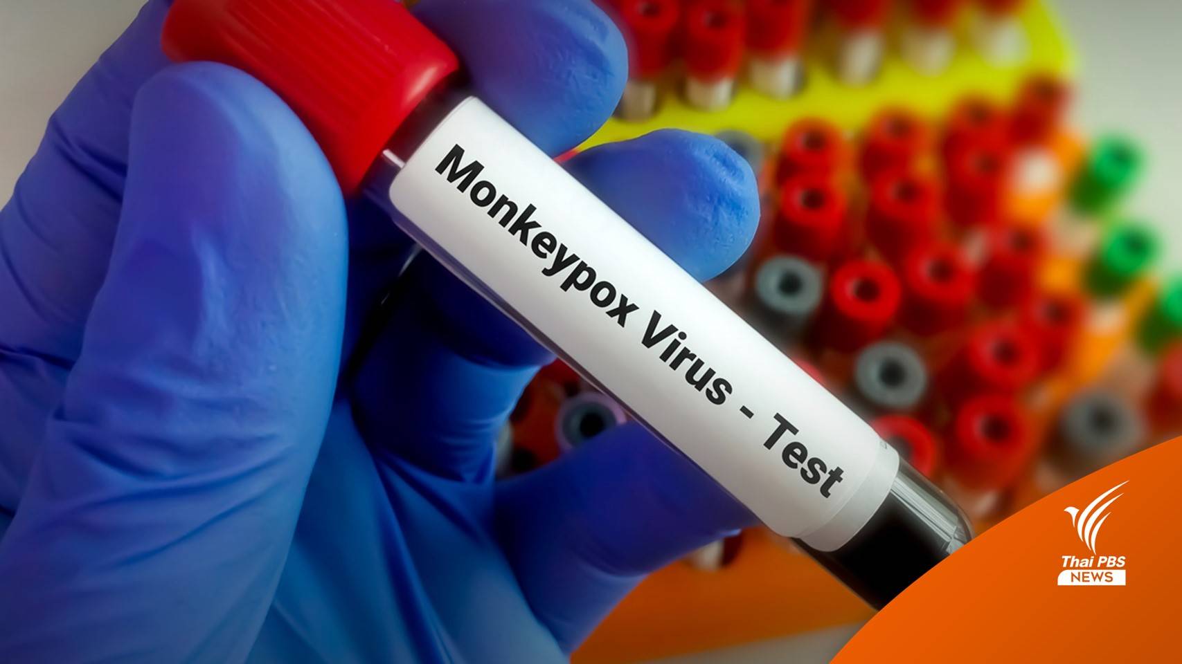 ลามเอเชีย "เกาหลีใต้-สิงคโปร์" พบผู้ป่วยยืนยันฝีดาษลิง