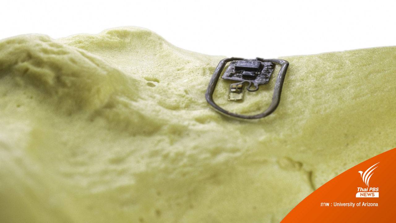 นักวิจัยสหรัฐฯ พัฒนาเซ็นเซอร์ไร้สายเชื่อมต่อกระดูกมนุษย์