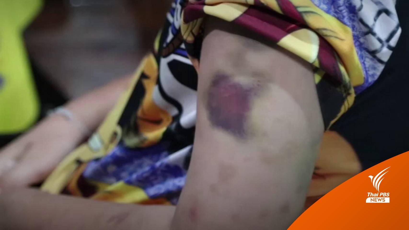 ผอ.วิทยาลัยนาฏศิลปสุพรรณบุรี ชี้แจงเหตุทำร้าย นร. ครูอ้างแค่หยอกล้อ