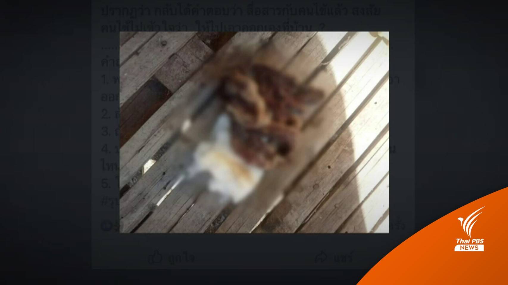 แม่ลูกอ่อนร้อง รพ."ลืมผ้าก๊อซ" ในช่องคลอดยาว 1 เมตร