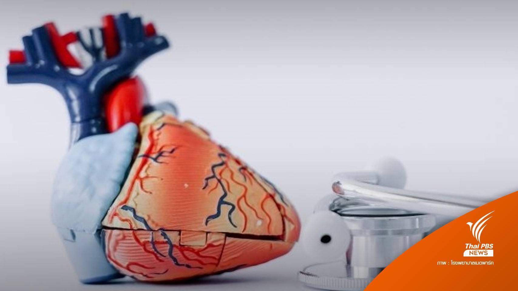 รู้ทัน "หัวใจวายเฉียบพลัน" เร่งตรวจ-รักษาก่อนจะสายไป