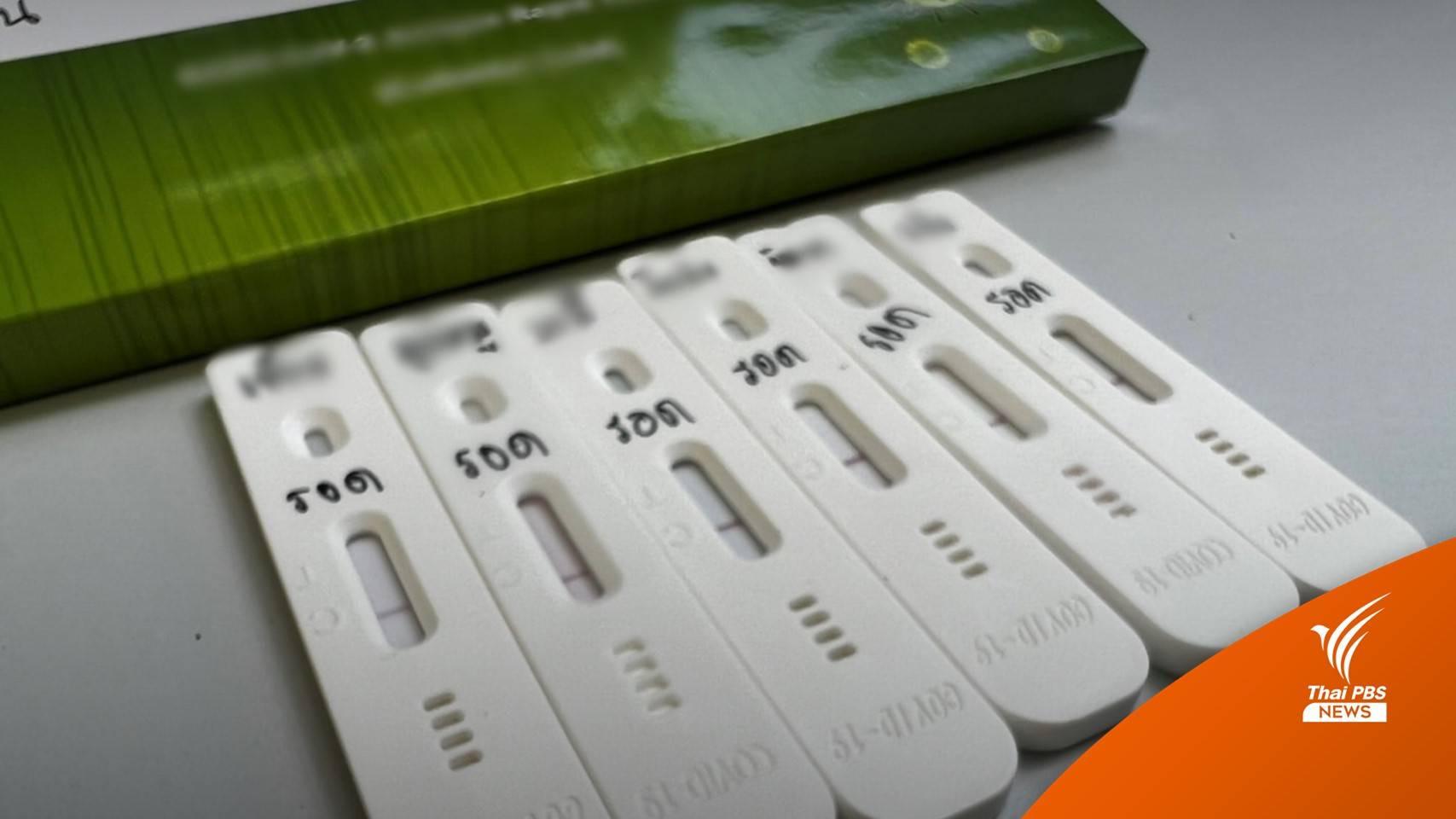 ขยะติดเชื้อเพิ่ม 87% สวนทางขยะมูลฝอยลดลงแค่ 1%