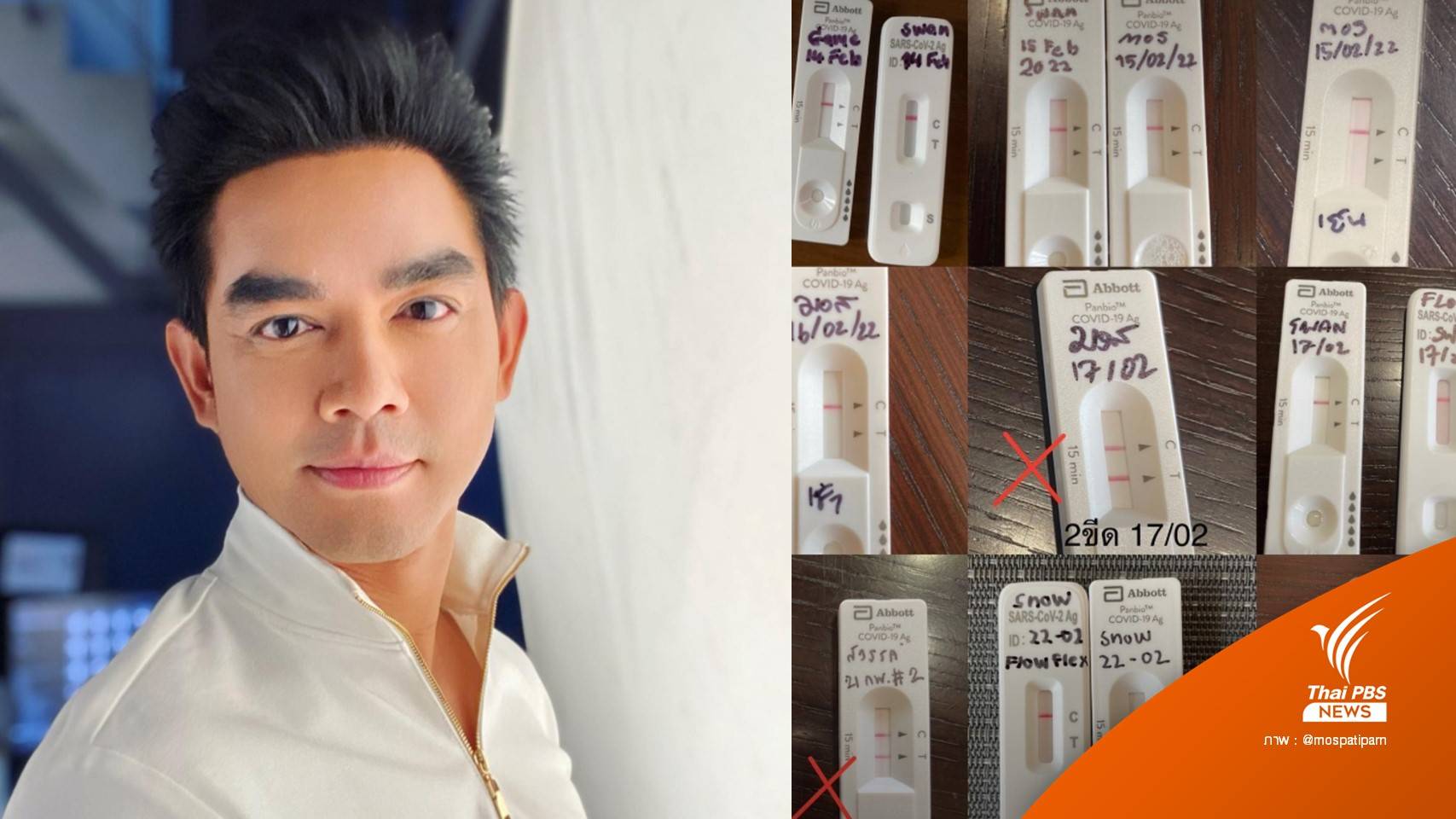 "มอส ปฏิภาณ" เล่าประสบการณ์ ป่วยโควิดยกบ้าน แต่หายดีแล้ว