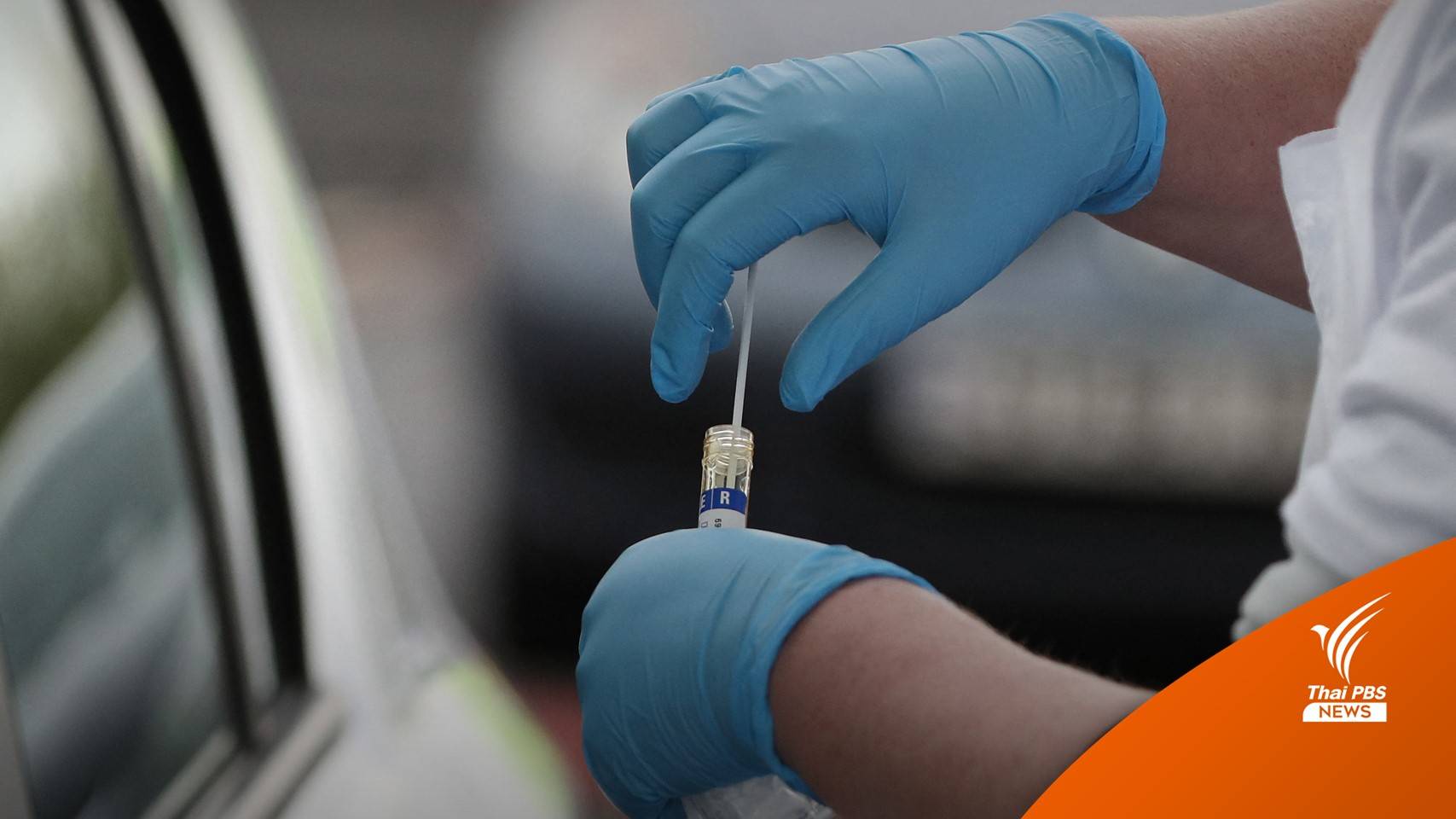 เริ่มวันนี้ รักษาโควิดแบบผู้ป่วยนอก กลุ่มที่ไม่มีอาการ ไม่มีความเสี่ยง