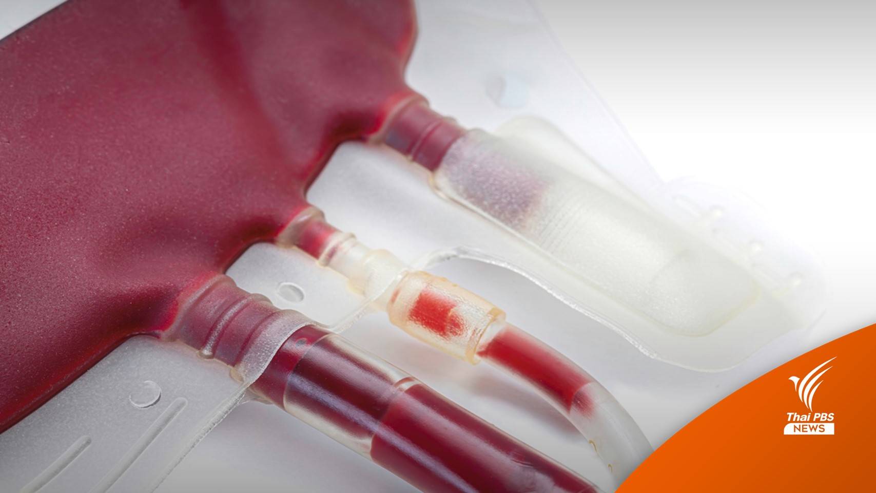 "ศิริราช" ขาดแคลนเลือดสำรองทุกกรุ๊ป ชวนบริจาคช่วยผู้ป่วย