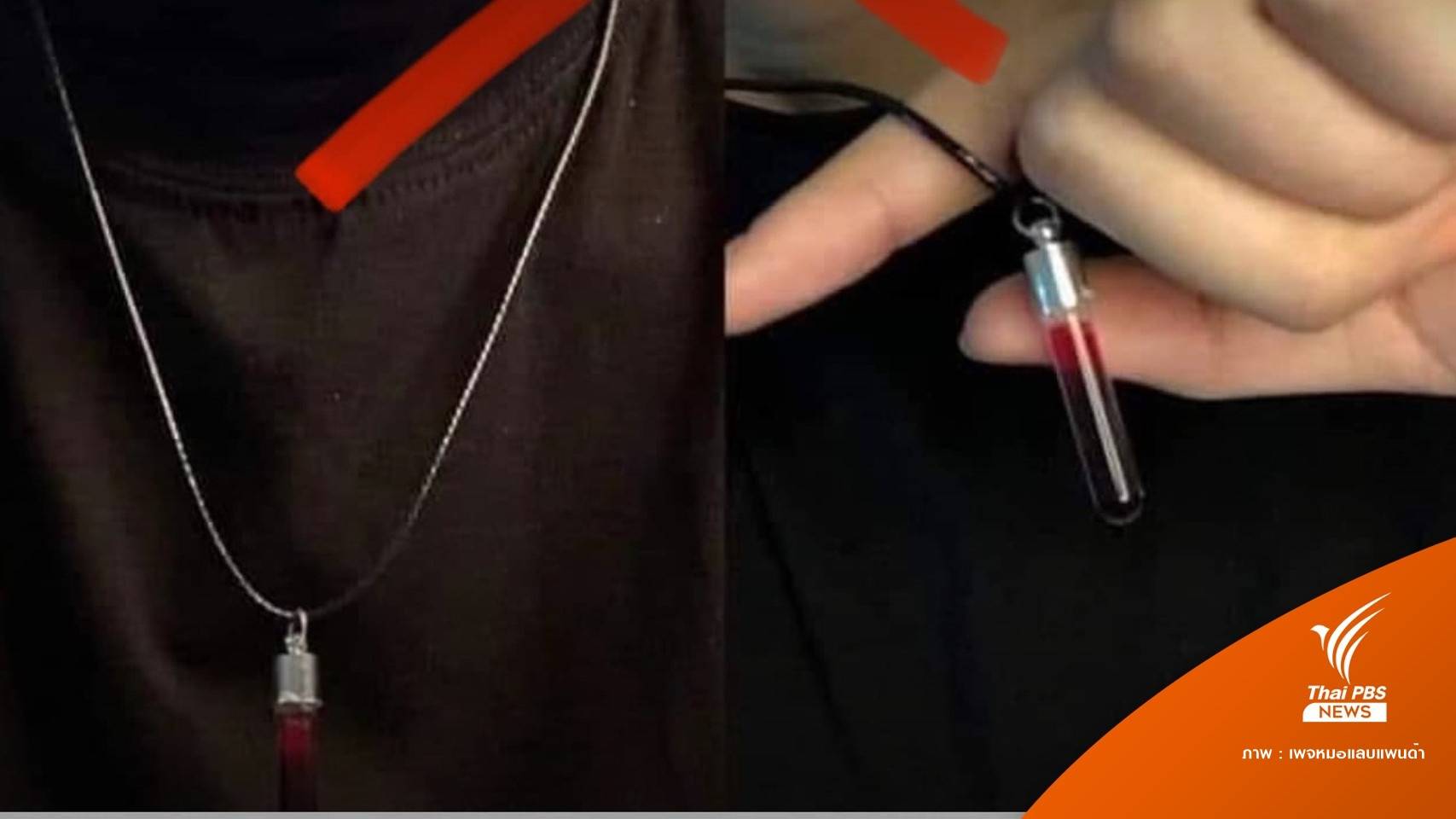 หมอห้าม "เจาะเลือดใส่ขวดห้อยคอ" เสี่ยงเชื้อโรค-ผิดกฎหมาย
