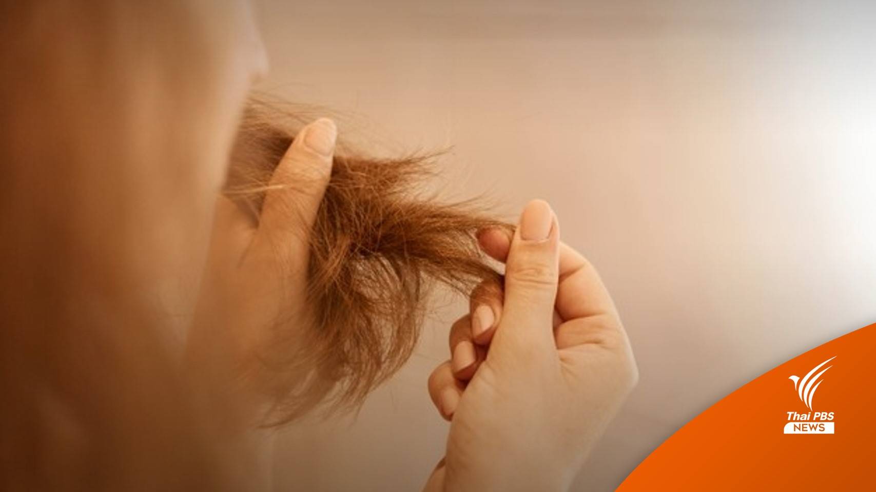 แพทย์ชี้ภาวะ “ผมร่วง” เกิดขึ้นได้หลังติดเชื้อ COVID-19