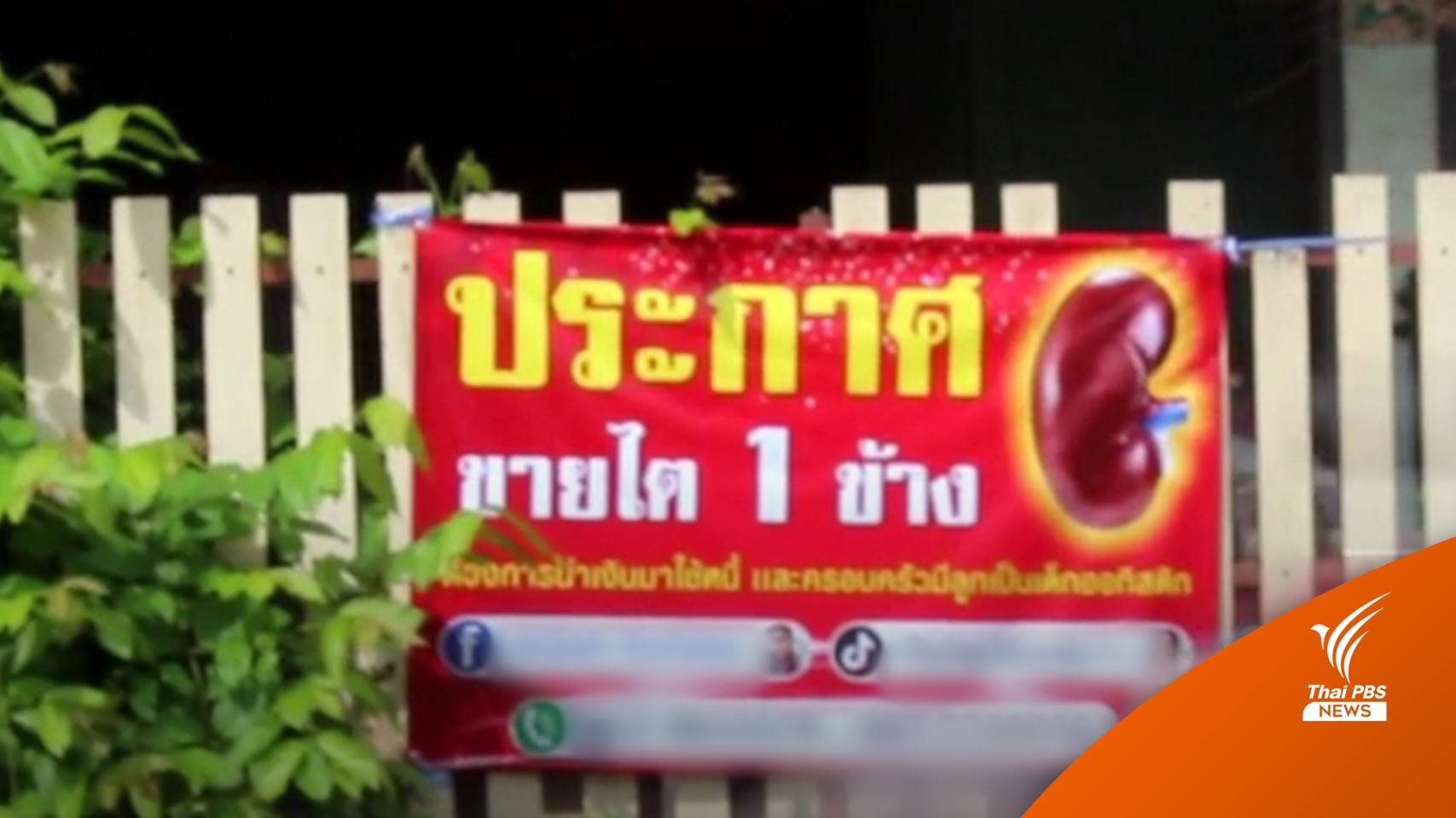 ขายไตแลกเงินทำได้หรือไม่?