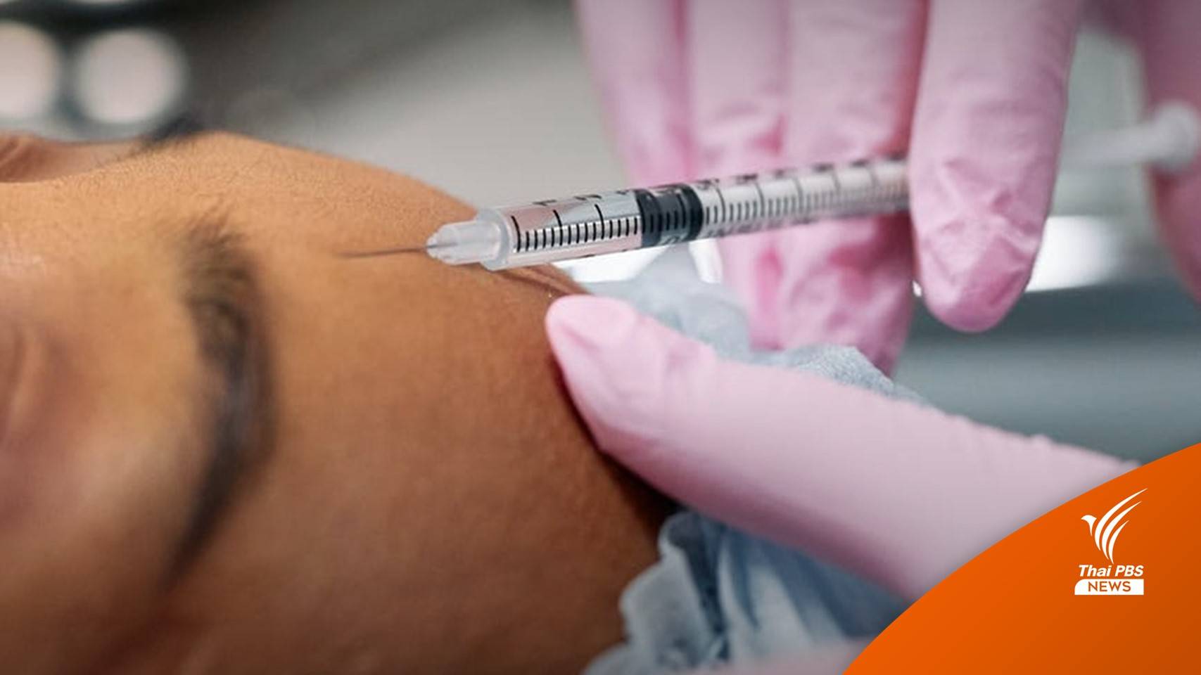หมอเตือนฉีดสารแปลกปลอมเข้าผิวหนัง ระวังผลข้างเคียง