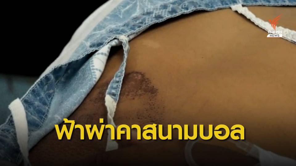 สลดฟ้าผ่าเด็กกลางสนามฟุตบอลตาย 1 เจ็บ 5 คน