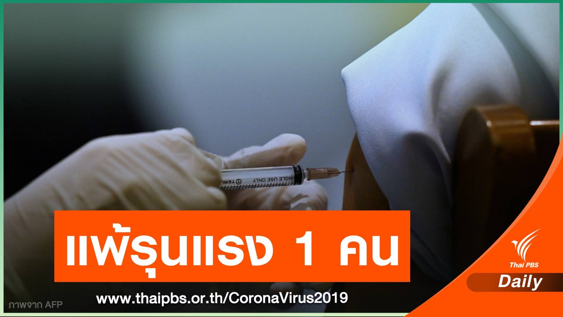 บุคลากรแพทย์ 1 คน แพ้รุนแรงหลังฉีดวัคซีน COVID-19