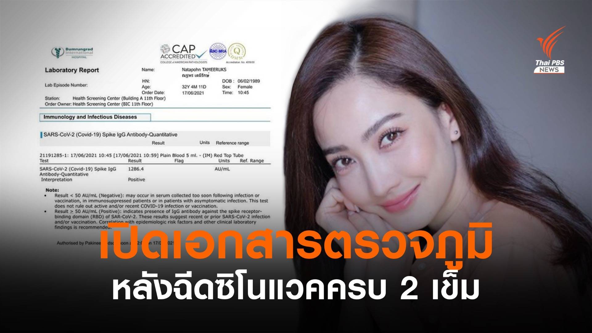 ภูมิคุ้มกันลด? "แต้ว ณฐพร" เปิดผลตรวจภูมิหลังฉีดวัคซีนซิโนแวคครบ 2 เข็ม