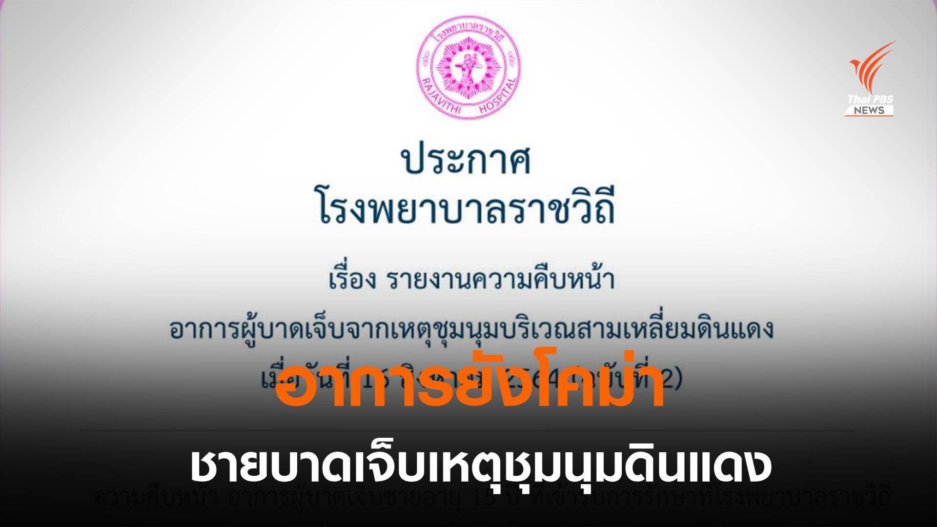รพ.ราชวิถี เผยผู้บาดเจ็บเหตุชุมนุมดินแดงยังโคม่า-ภาวะแทรกซ้อนสมองบวม