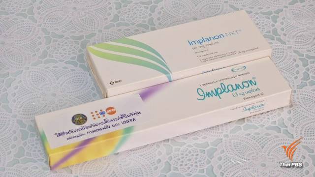 ปรับทัศนคติผู้ให้บริการ-วัยรุ่นใช้ "ยาฝังคุมกำเนิด" ป้องกันตั้งครรภ์