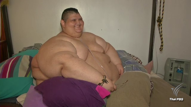 ชายอ้วนที่สุดในโลก ลดน้ำหนัก 175 กก.เตรียมผ่าตัดโรคอ้วน